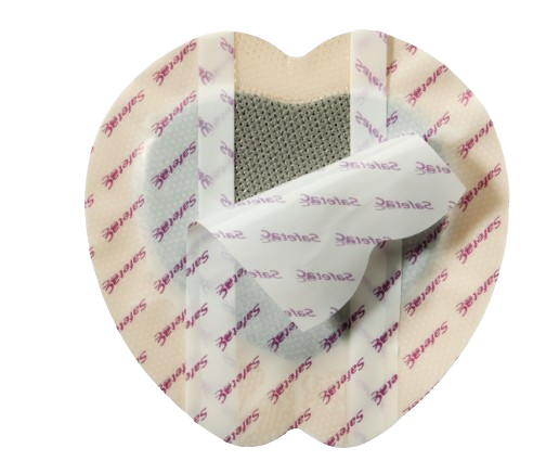 MOLNLYCKE Mepilex Border Sacrum Ag 23x23cm 5s