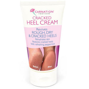 Carnation Cracked Heel Cream 50g